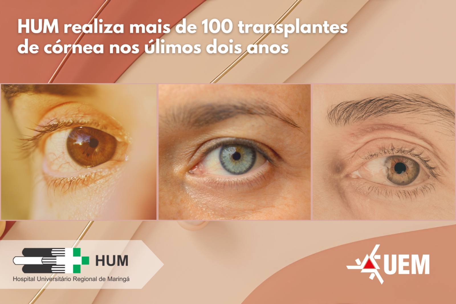 Cirurgias oftalmológicas somam 168 no mesmo período. Hospital é referência em traumas oculares na 15ª Regional